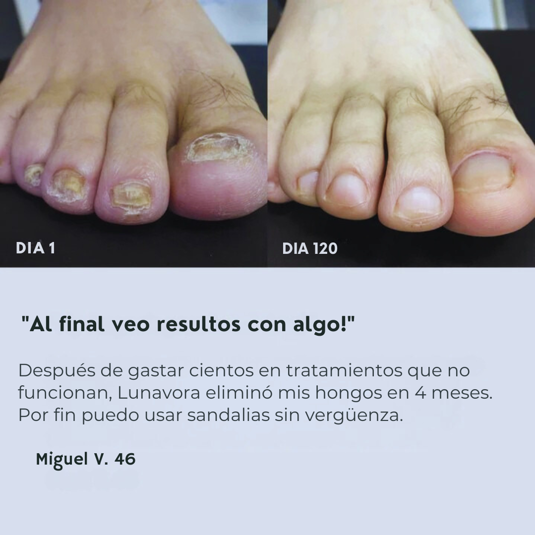 Lunavora™ Gotas Antihongos