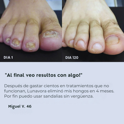 Lunavora™ Gotas Antihongos